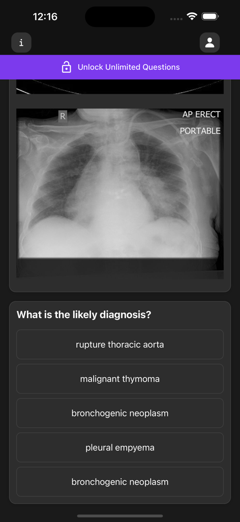 Chest x-ray diagnostic quiz question with multiple choice options in the Basic Radiology medical app