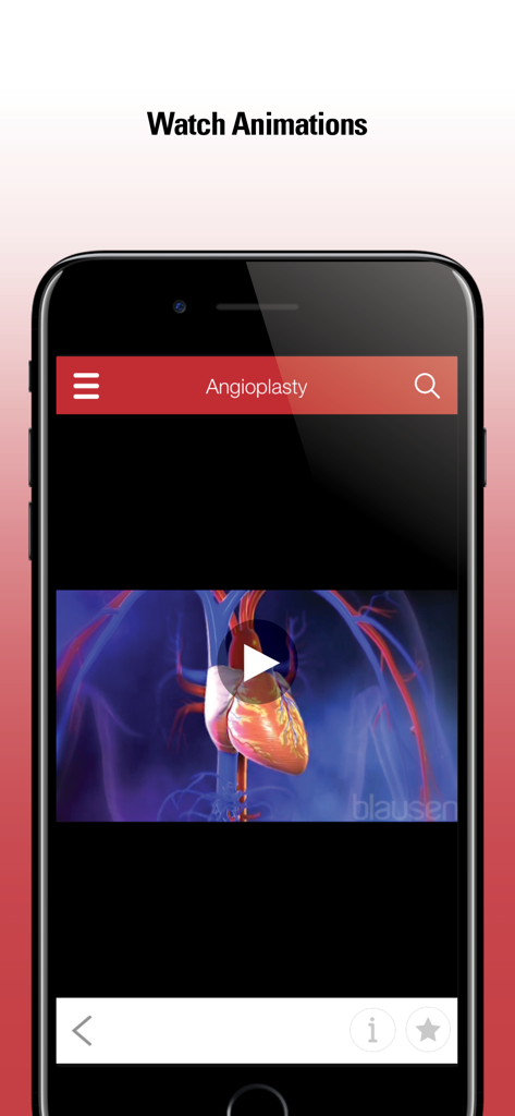 Merck Manual Consumer - Smartphone screen showing a medical animation of an angioplasty procedure in the Merck Manual Consumer app