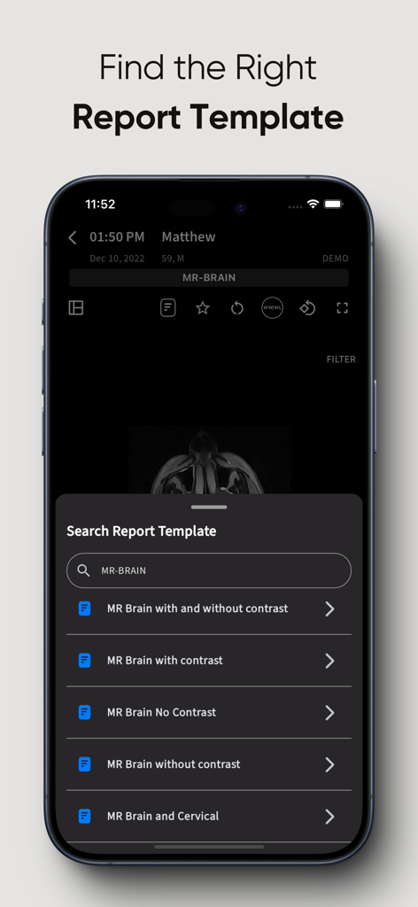 RadioView.AI app screen showing the search for MRI brain report templates