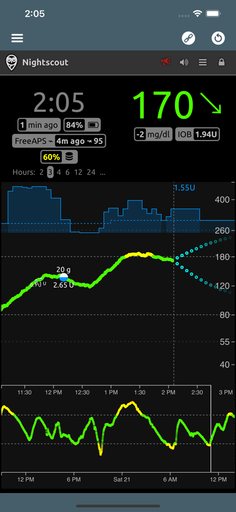 Nightscout X app dashboard displaying real-time blood glucose levels and trend graphs
