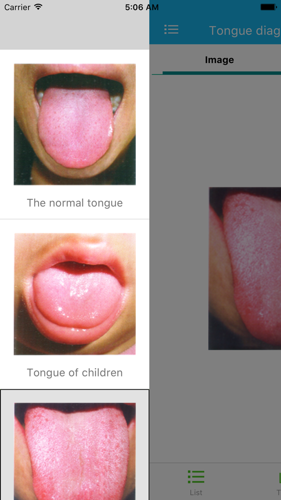 Tongue diagnosis handbook - Traditional Chinese Medicine app displaying visual examples of a normal tongue and a child tongue for diagnosis