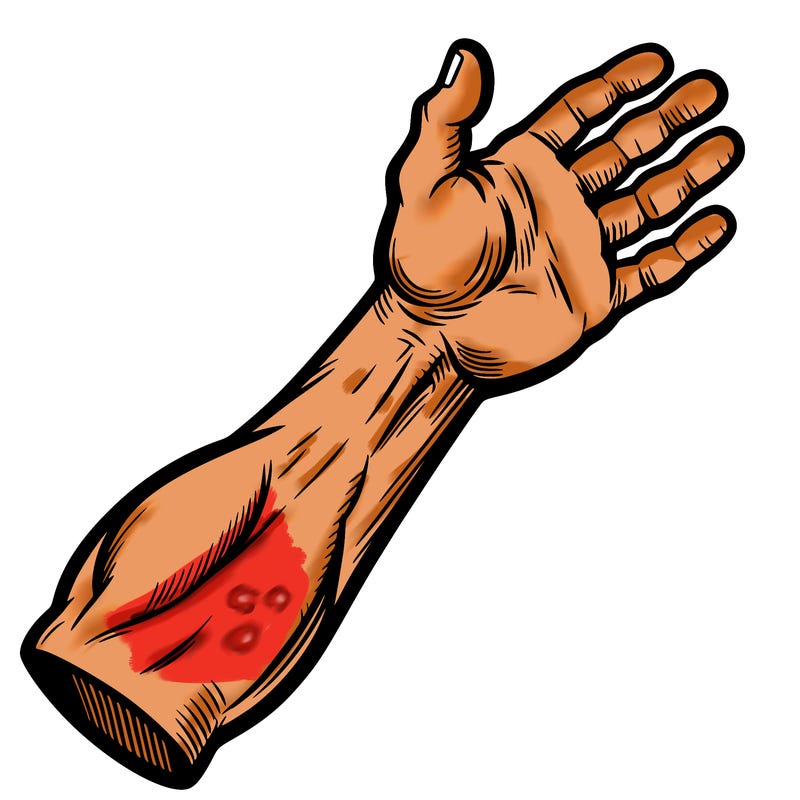 an arm
