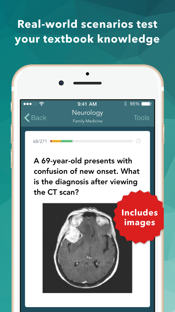 A neurology clinical case scenario with a CT scan image in the Family Medicine Board Review app