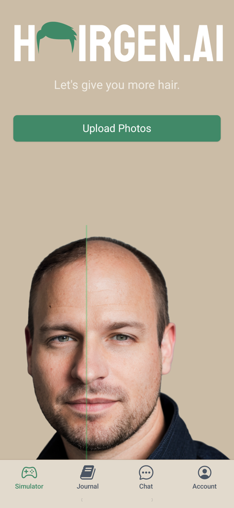 Split screen view of a man showing before and after hair transplant simulation in the Hairgen ai app