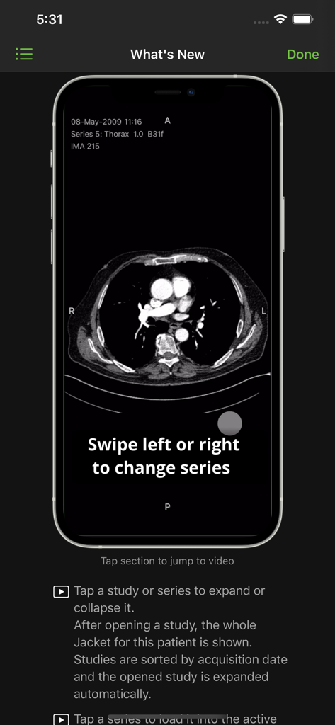 Visage Ease - Visage Ease app interface showing a thorax CT scan and navigation instructions