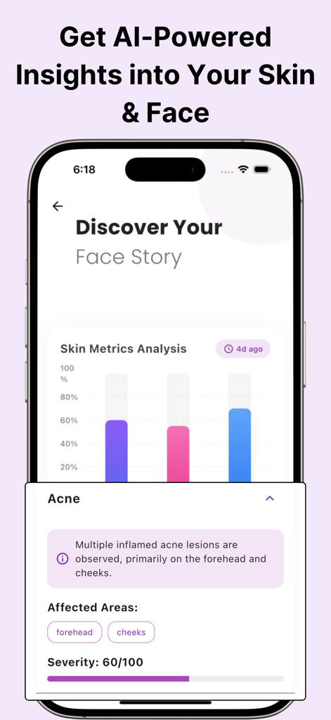 Glow AI - Skin Care AI Coach - Glow AI app interface showing skin metrics analysis and detailed acne severity report