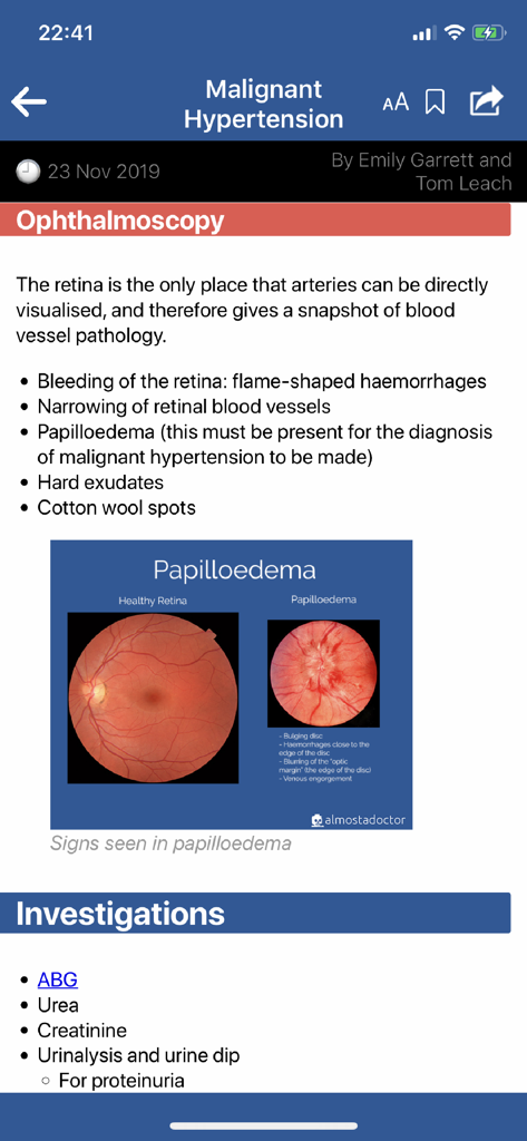 almostadoctor - Medical encyclopedia article on Malignant Hypertension showing ophthalmoscopy and clinical signs.
