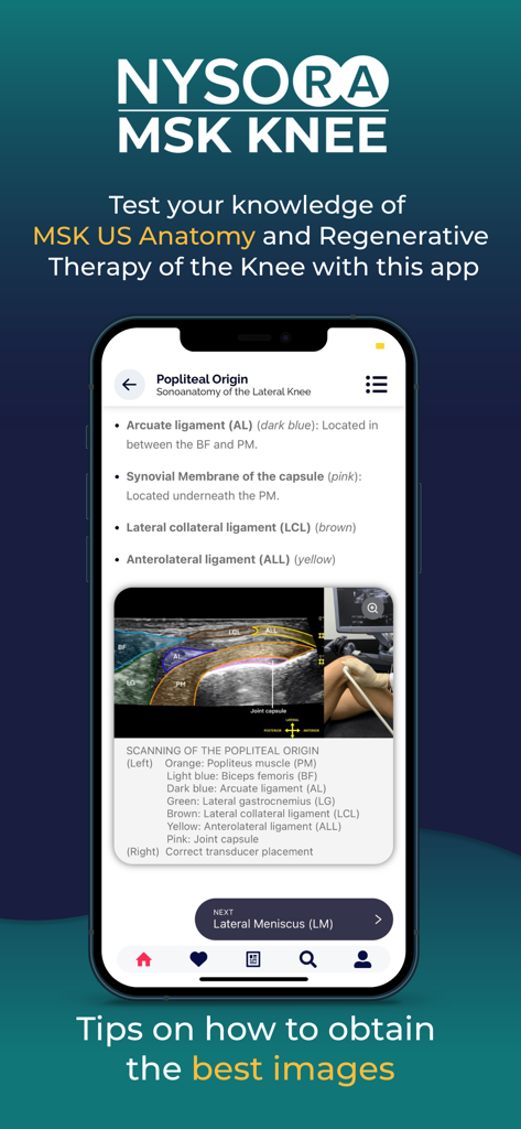 NYSORA MSK US Knee - Education App | MWM