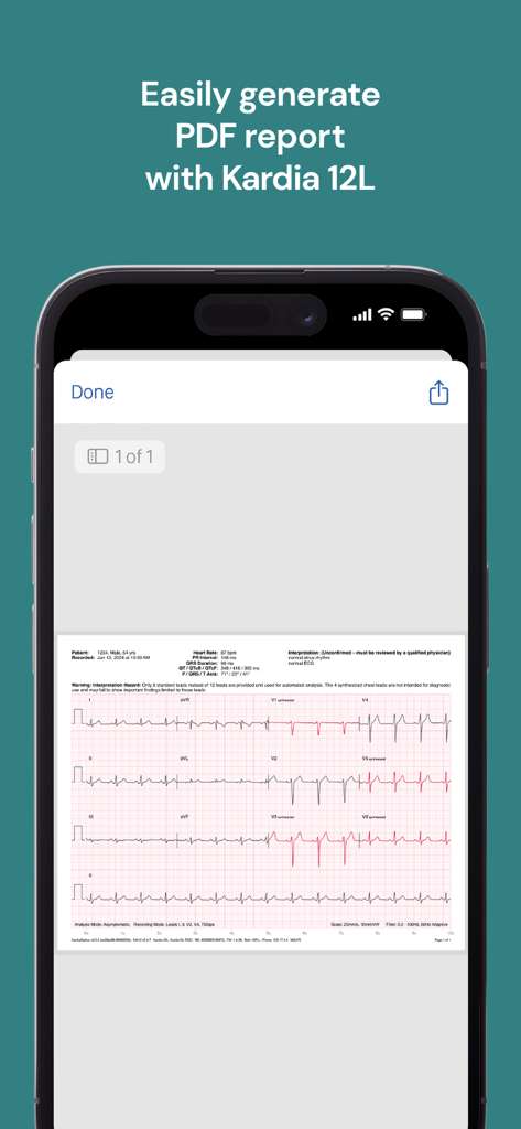 KardiaStation Professional - Vista previa de un informe PDF de ECG profesional de 12 derivaciones en la aplicación KardiaStation