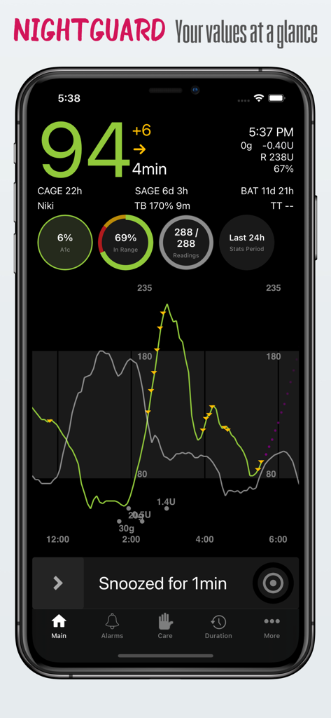 nightguard - Nightguard app interface showing real-time blood glucose levels and data visualization chart