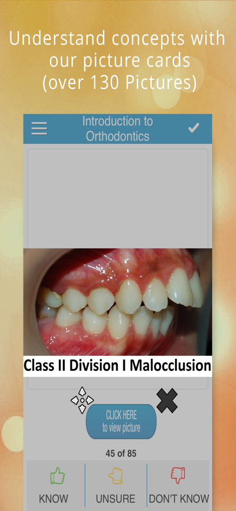 Orthodontics digital flashcard showing a Class II Division I Malocclusion with study options