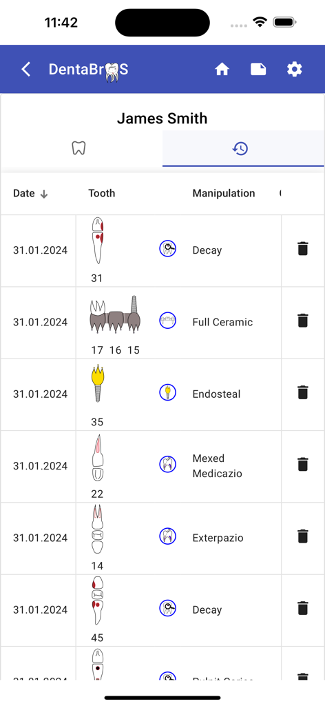 Dentabros - Dental Software - 환자의 치아 다이어그램 및 임상 절차를 보여주는 DentaBros 앱의 상세 치과 기록 로그.