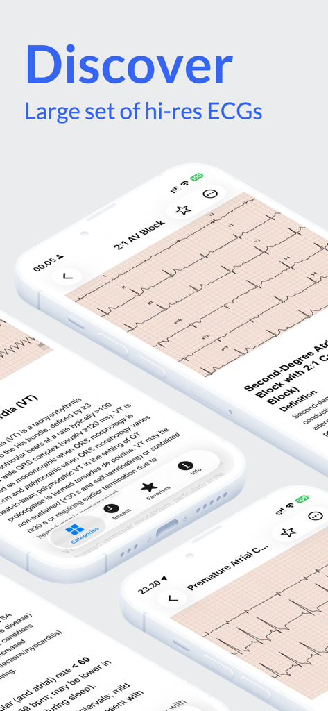 Die Benutzeroberfläche der EKG Atlas App zeigt hochauflösende EKG-Messwerte und medizinische Definitionen auf mehreren Smartphone-Bildschirmen.