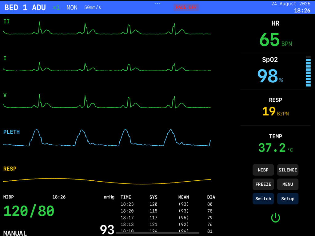 EKG Simulator - Interfaz realista de monitor de paciente de hospital con formas de onda de EKG y signos vitales en un iPad