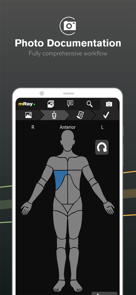Capture d'écran de l'application mobile mRay montrant la documentation photographique médicale et la cartographie anatomique sur un schéma du corps humain