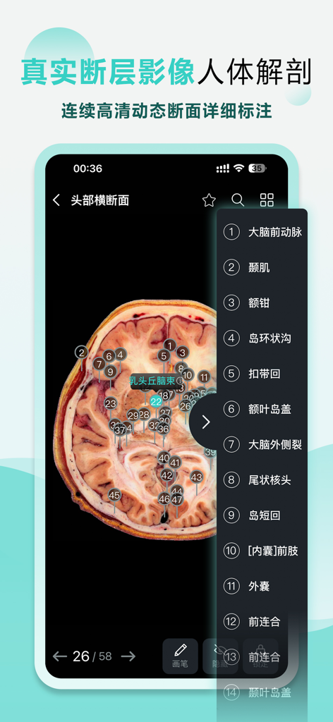 掌上3D解剖 - A mobile app interface displaying a detailed human brain cross-section with numbered anatomical labels.