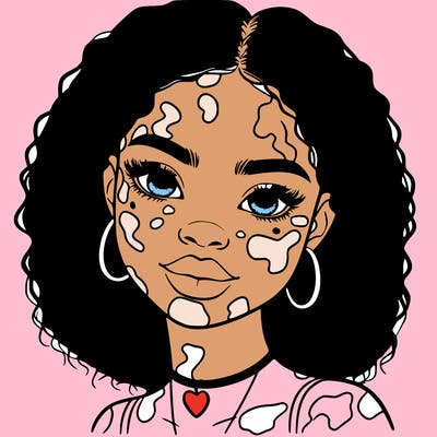 bleautiful black girl with vitiligo