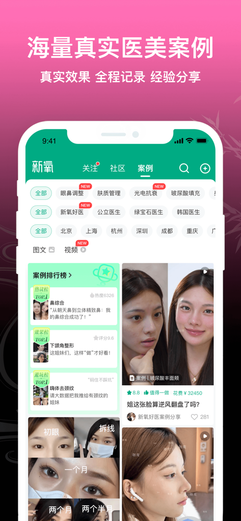 Interface of the SoYoung Lite app showcasing real medical beauty case studies and before and after photos.