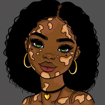 bleautiful black girl with vitiligo
