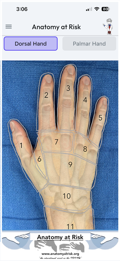 Anatomy at Risk - Medical App | MWM