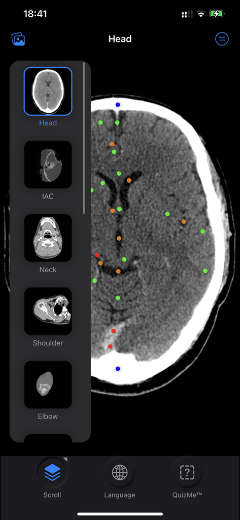 CT scan of the head with color-coded anatomical pins in the CT Anatomy app interface
