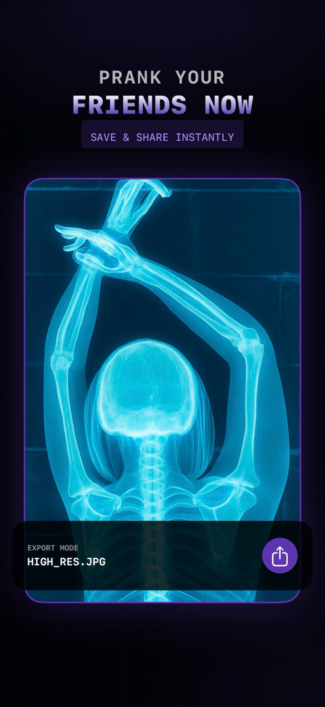 Mobile app interface of X-Ray Camera AI showing a blue skeletal x-ray filter effect and sharing options
