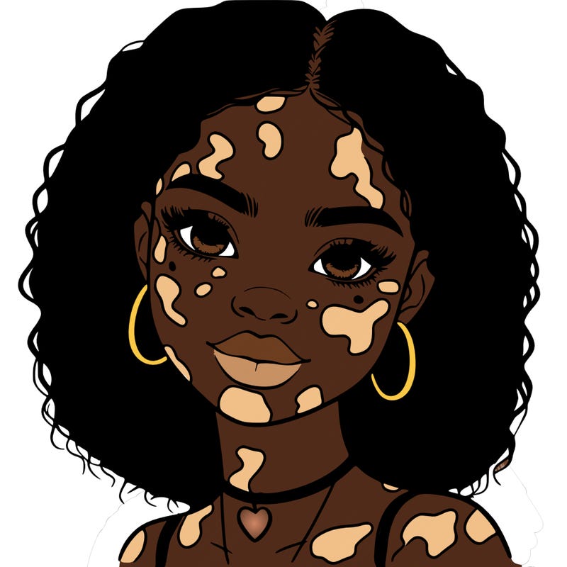 bleautiful black girl with vitiligo
