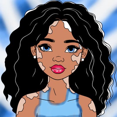 beautiful black girl with vitiligo