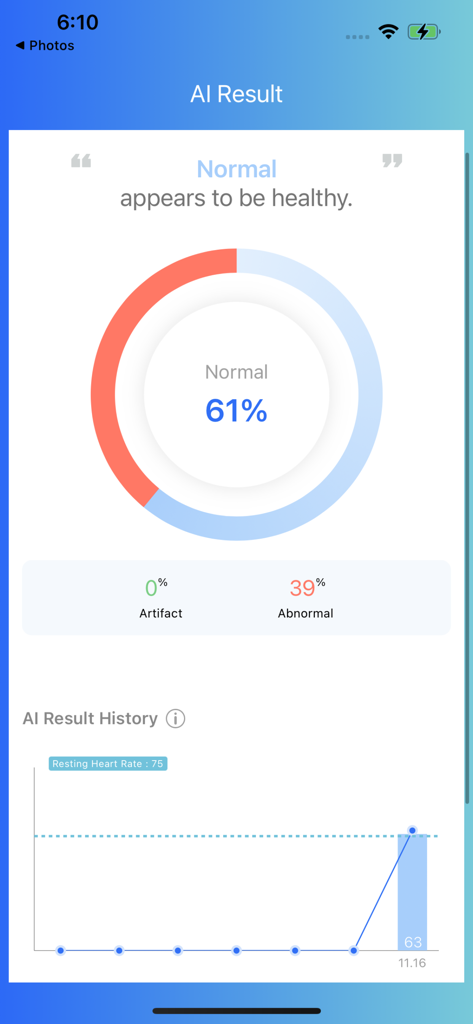 App Skeeper Health Mate che mostra il risultato AI per l'analisi della salute cardiaca e polmonare con un grafico di tendenza storica