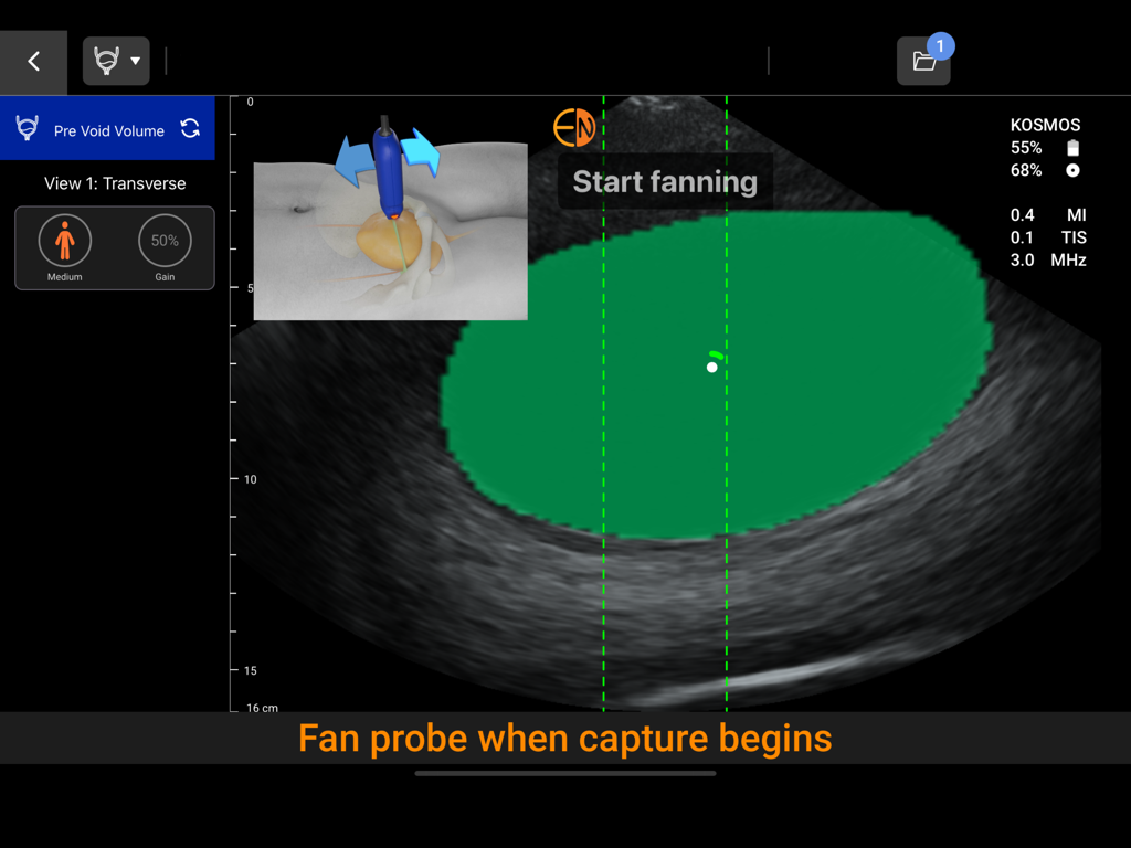Kosmos Ultrasound 4.0 - Kosmos Ultrasound app interface showing AI-assisted bladder scanning with probe fanning instructions
