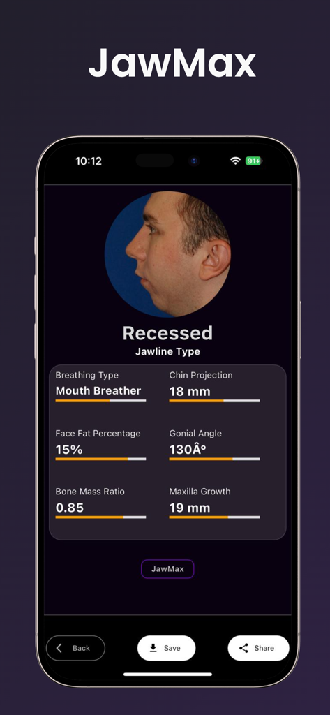 JawMax - JawMax app screen displaying AI jawline scan results and facial metrics
