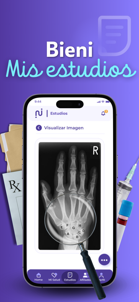 Ein Smartphone-Bildschirm, der eine Röntgenaufnahme der Hand in der Bieni Health Wallet App anzeigt, umgeben von medizinischen Symbolen