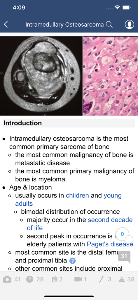 Screenshot of the Bullets app displaying an educational topic on Intramedullary Osteosarcoma with medical and histological images.