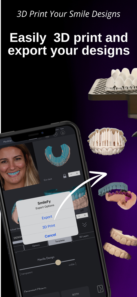 SmileFy TNG - Interfaz de la aplicación SmileFy TNG que muestra opciones de impresión 3D y exportación para diseños de sonrisas dentales
