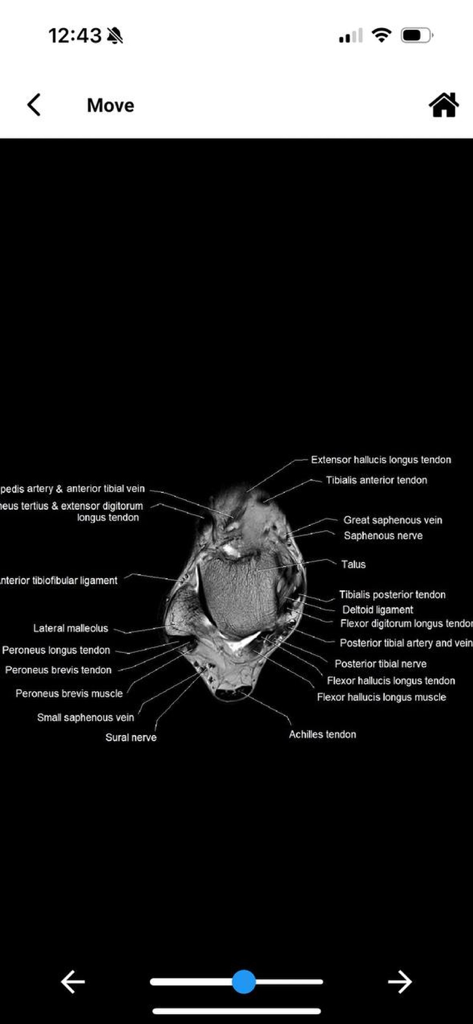 MRI MASTER - Cross-sectional MRI scan of an ankle with detailed anatomical labels in the MRI MASTER app