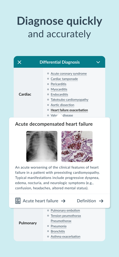 AMBOSS Medical Knowledge - AMBOSS app interface for differential diagnosis showing clinical details and images for heart failure.