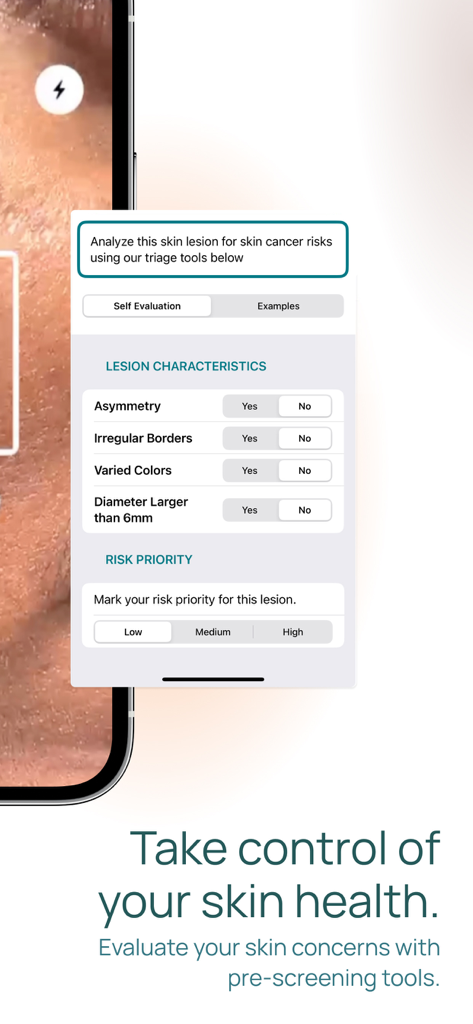 Self evaluation screen of the Skin-Check app for analyzing skin lesion risks.