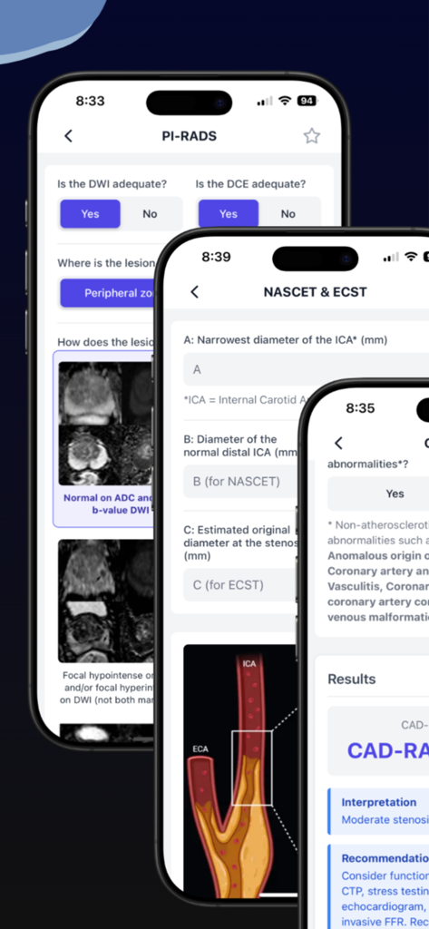 Screenshots of the Radiology Calculators app displaying PI-RADS, NASCET, and CAD-RADS diagnostic tools for radiologists.