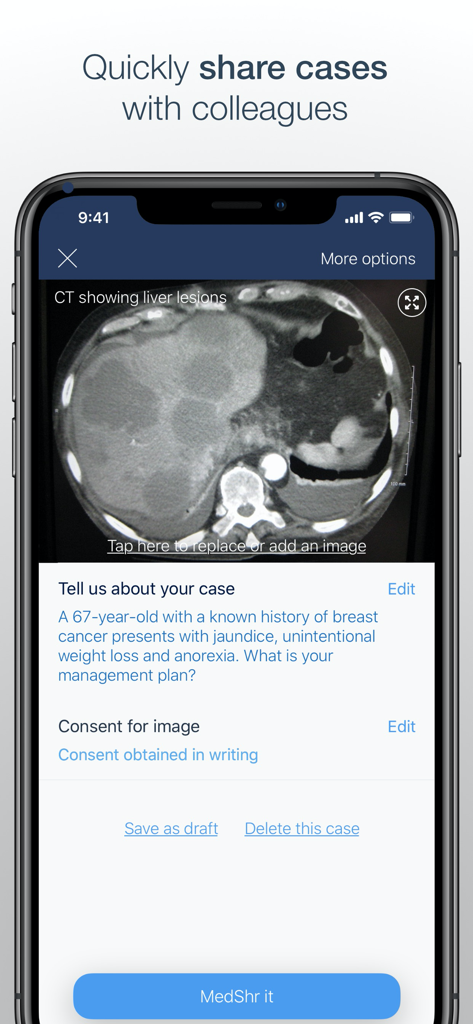 MedShr: The App for Doctors - MedShr app screen showing a CT scan of liver lesions with a patient case description and consent confirmation.