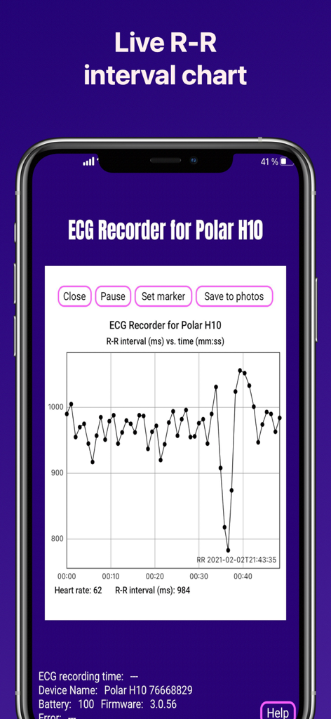 ECG Recorder for Polar H10 - A live RR interval chart on a smartphone screen from the ECG Recorder for Polar H10 app