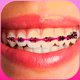 Braces Photo Editor - Stickers