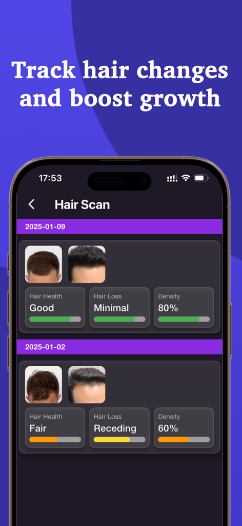 Hair Scan - Hair Snap Health - Dashboard of Hair Scan app showing hair health and density tracking over time