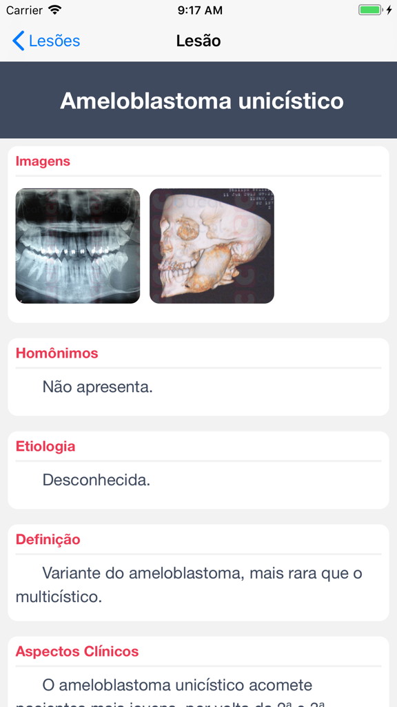 Bucal app interface showing diagnostic information and radiographic images for unicystic ameloblastoma.