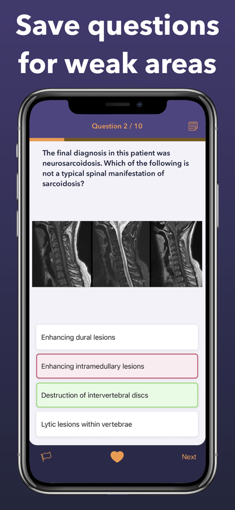 A radiology exam practice question with spinal MRI images and multiple choice options on a mobile device.