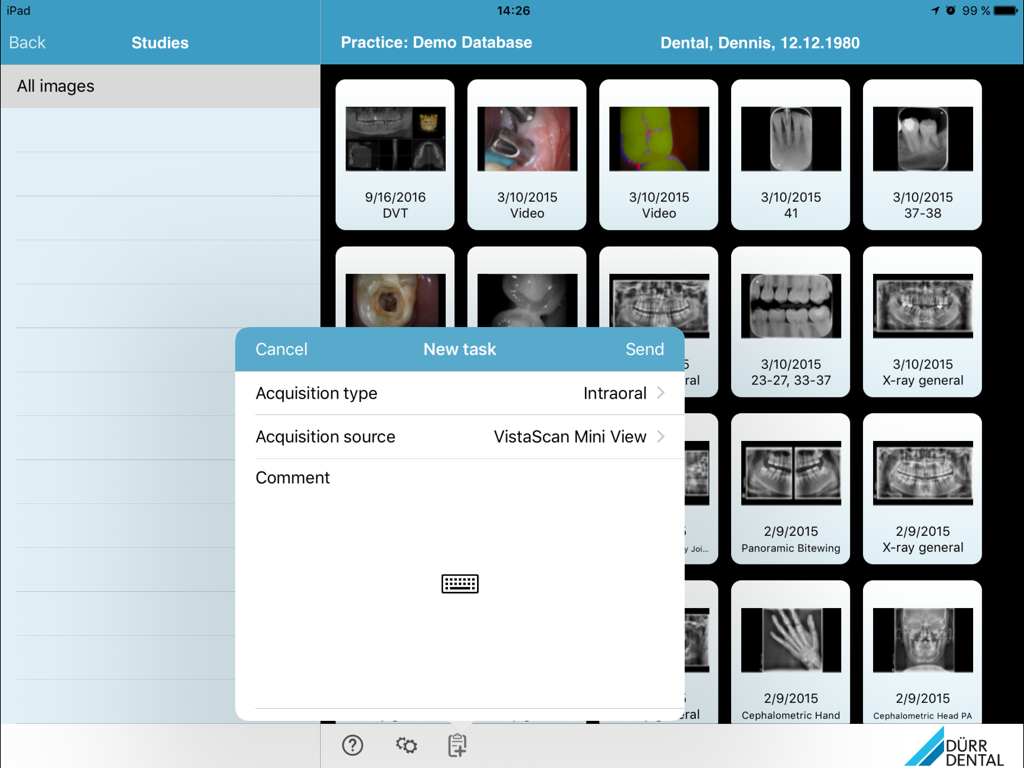 Duerr Dental Imaging app interface showing a new task window for intraoral scan setup over a gallery of patient dental images