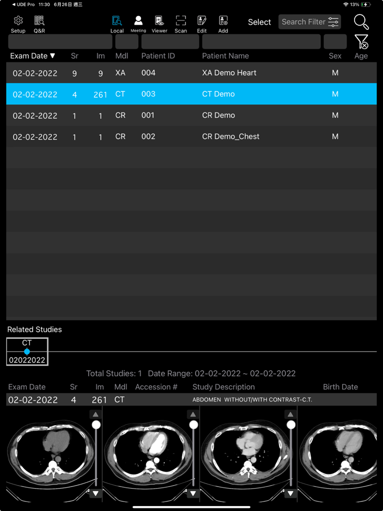 UDE Lite app interface showing a list of medical studies and CT scan previews