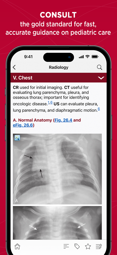 Harriet Lane Handbook - Harriet Lane Handbook app screen showing pediatric radiology chest imaging guidelines and X-ray figures.
