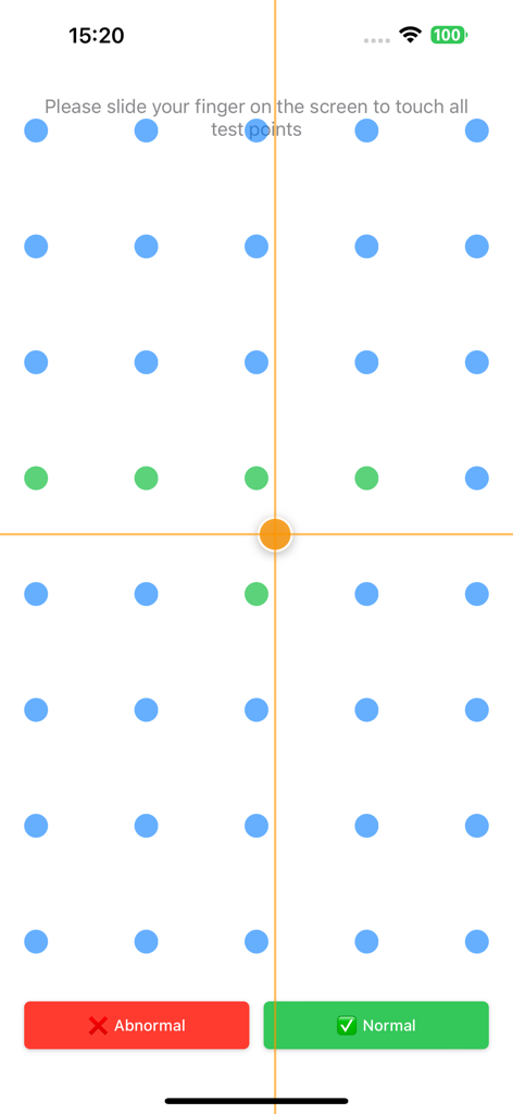 Phone Diagnostics Expert - Interface of a mobile app showing a grid of dots for testing screen touch responsiveness with normal and abnormal result buttons