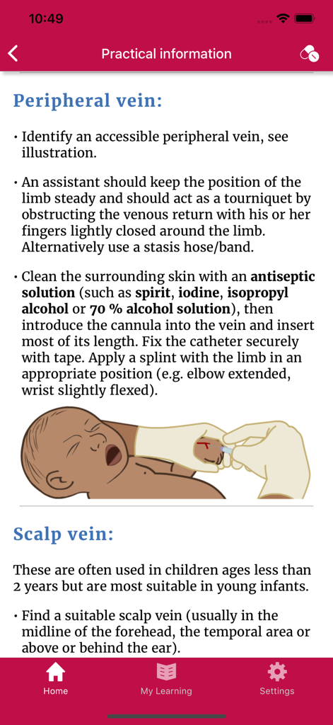 Safe Delivery - Safe Delivery app interface showing clinical instructions and illustration for neonatal peripheral vein access