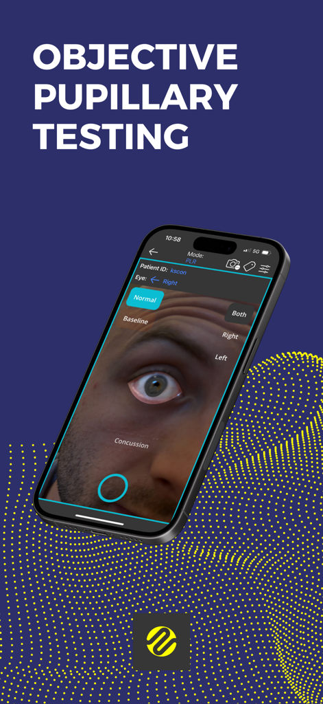 Reflex app interface showing objective pupillary testing on a patient's eye for concussion analysis